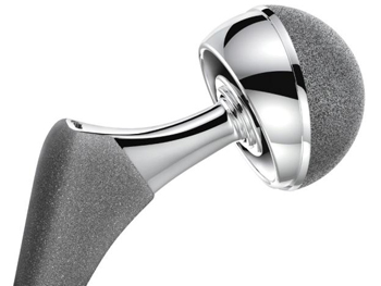 titanium hip prothesis and mrsa titanium hip prothesis and mrsa