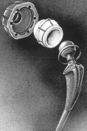 hip implant components